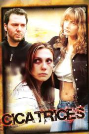 Cicatrices filmas