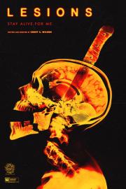 Lesions filmas