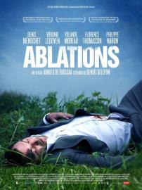 Ablations filmas