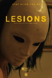 Lesions filmas