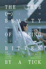 The True Beauty of Being Bitten by a Tick filmas