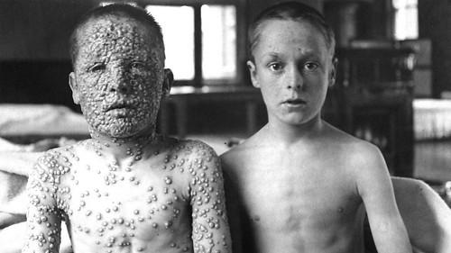 Outbreak: Anatomy of a Plague filmas žiurėti online