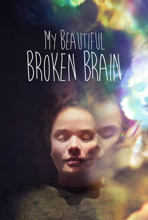 My Beautiful Broken Brain filmas online