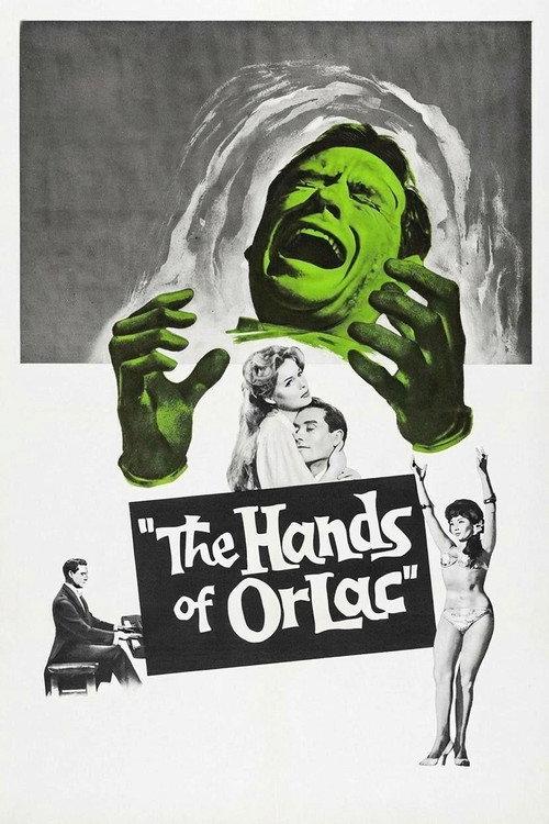 The Hands of Orlac filmas online